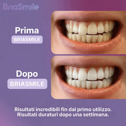 Strisce Sbiancanti Dentali - BriaSmile